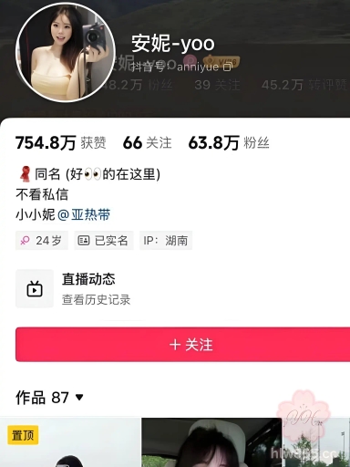 抖音网红极品女神 安妮yoo 微密圈付费新作 黑色情趣衣 巨乳肥臀诱人至极 3